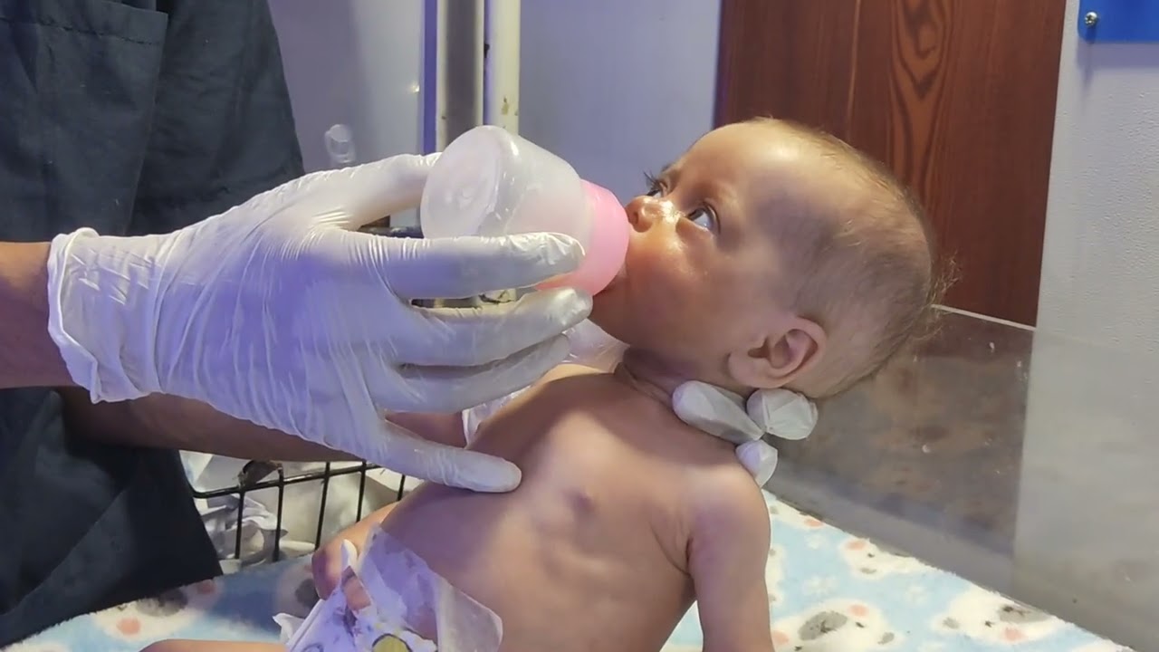 Kids care.  Feeding for a baby.laprotomy patient #kidscare #newbornbaby