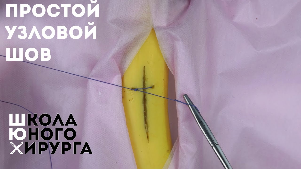 простой узловой шов (техника; как наложить)