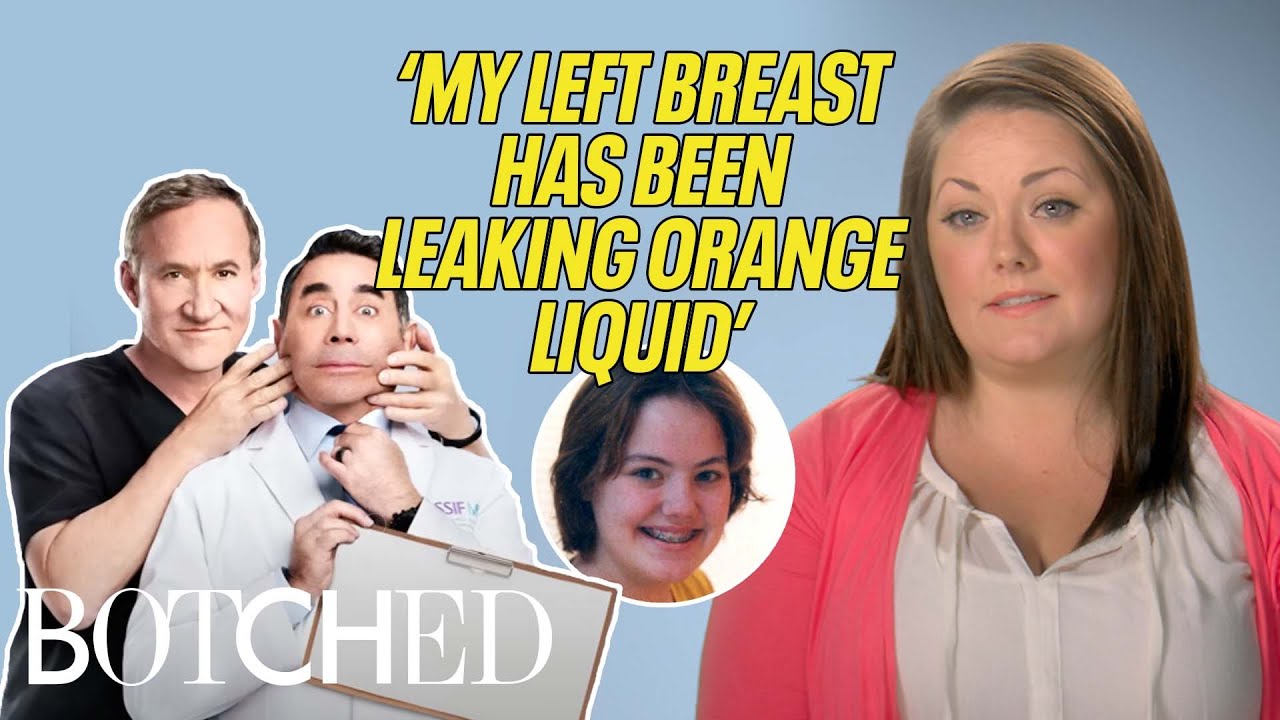 Erica's Left Breast Is LEAKING Orange Liquid?! (Before & After) | Botched | E!