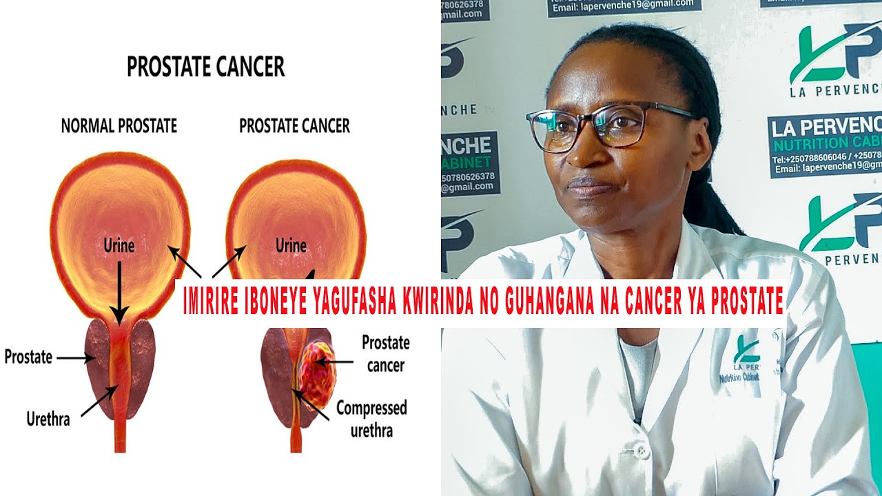 IMIRIRE IBONEYE KURI PROSTATE