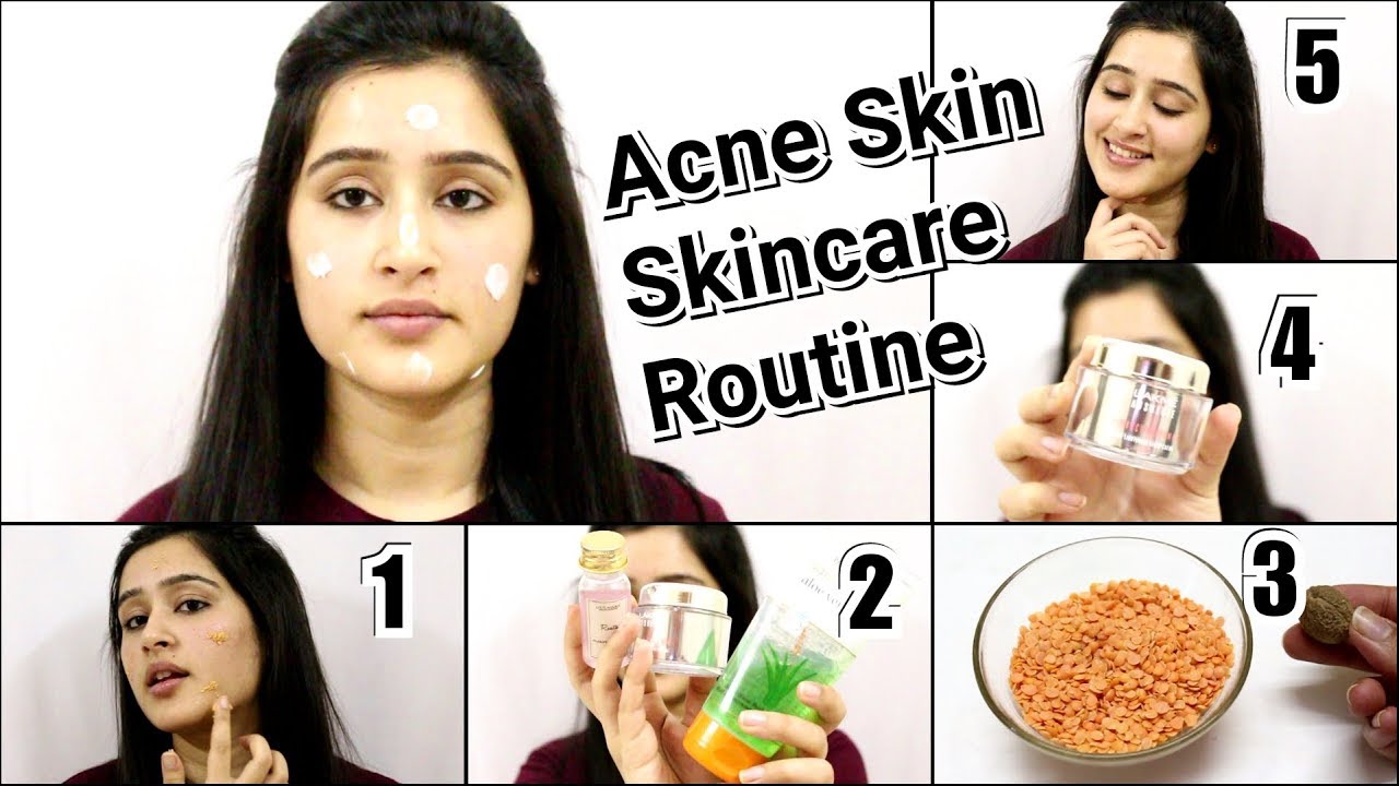 Skincare Routine for Sensitive Skin and Acne Prone skin- Get Clear and Glowing skin