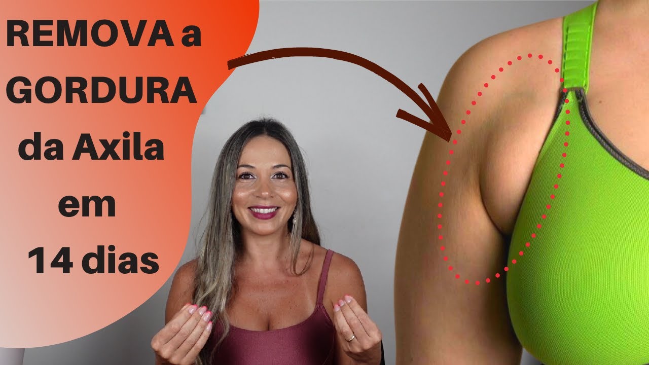 Como Acabar com a Gordura entre o SEIO e a AXILA - GORDURA PRÉ-AXILAR ou Mama Acessória?