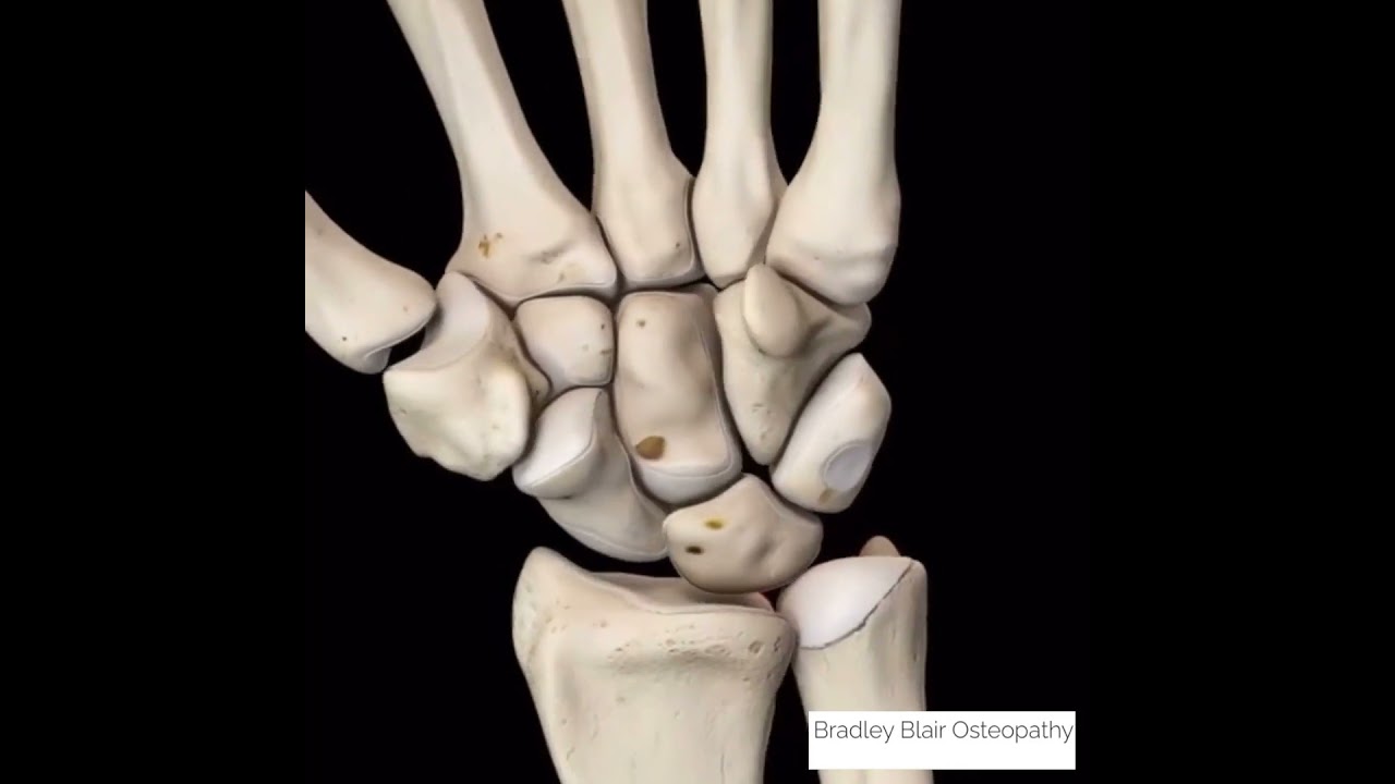 Ulnar Impaction Syndrome
