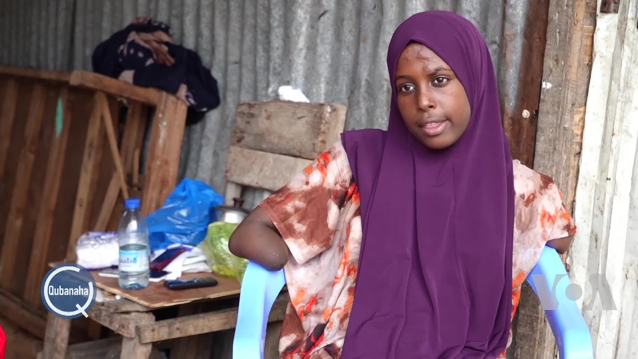 Sheekada Salma Yariisey oo ah gabadh gacmaha ka go'an.
