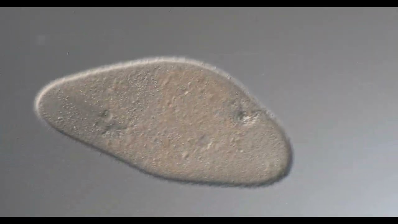 Ciliate Ophryoglena  200x