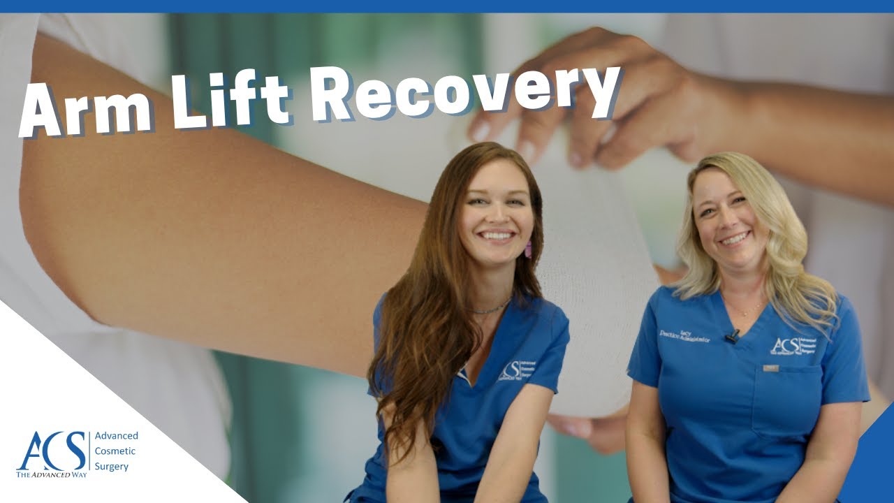 Arm Lift Recovery: What You Should Expect