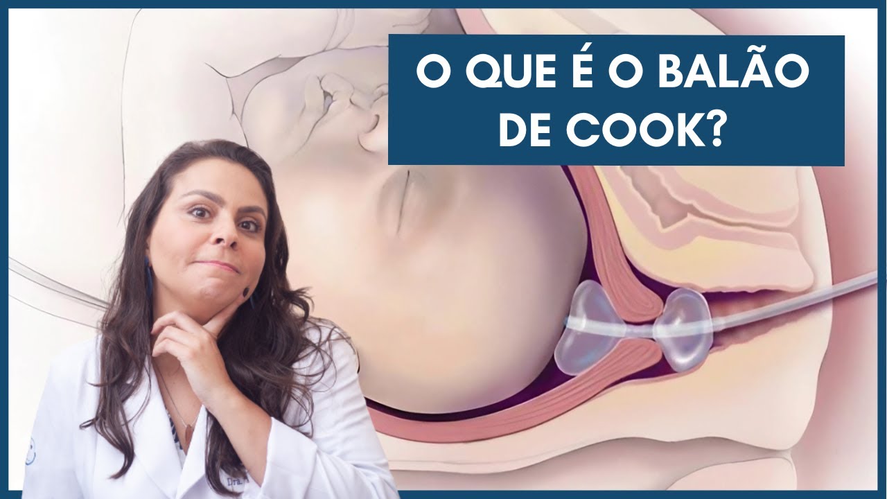 O que é o balão de cook? | Dra. Maíra de La Rocque