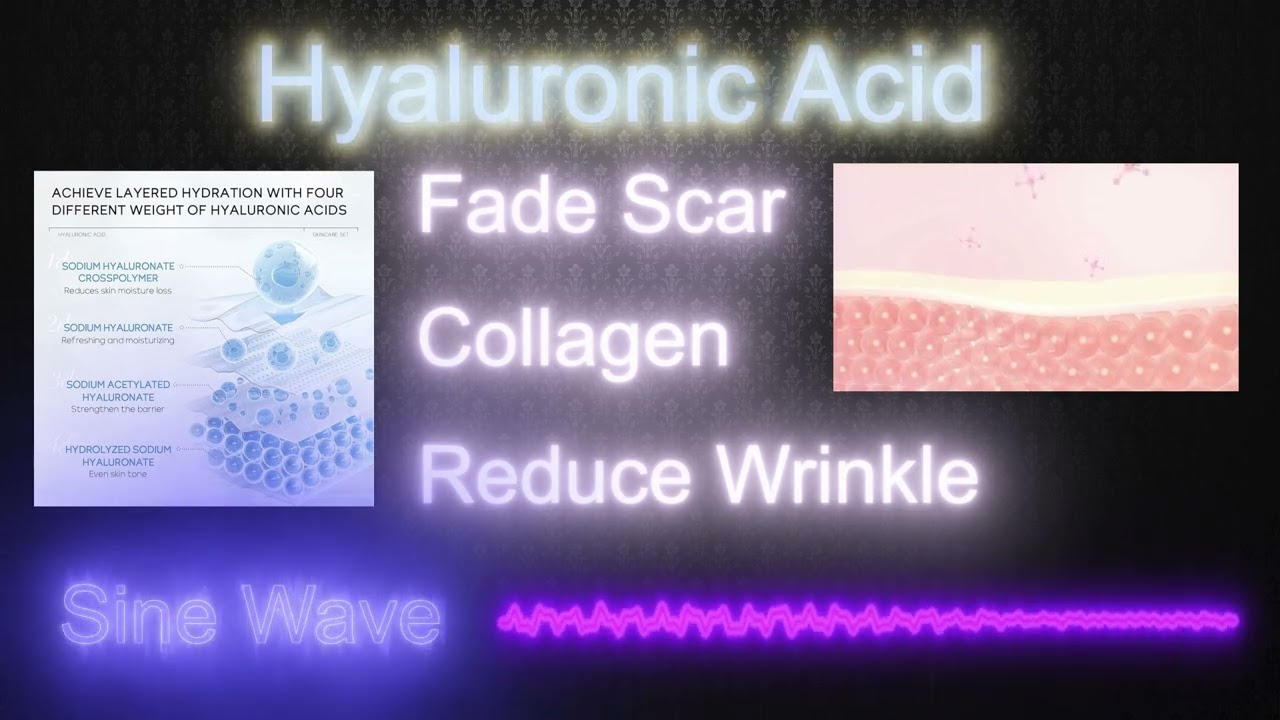 Hyaluronic Acid Molecular Weight Frequency
