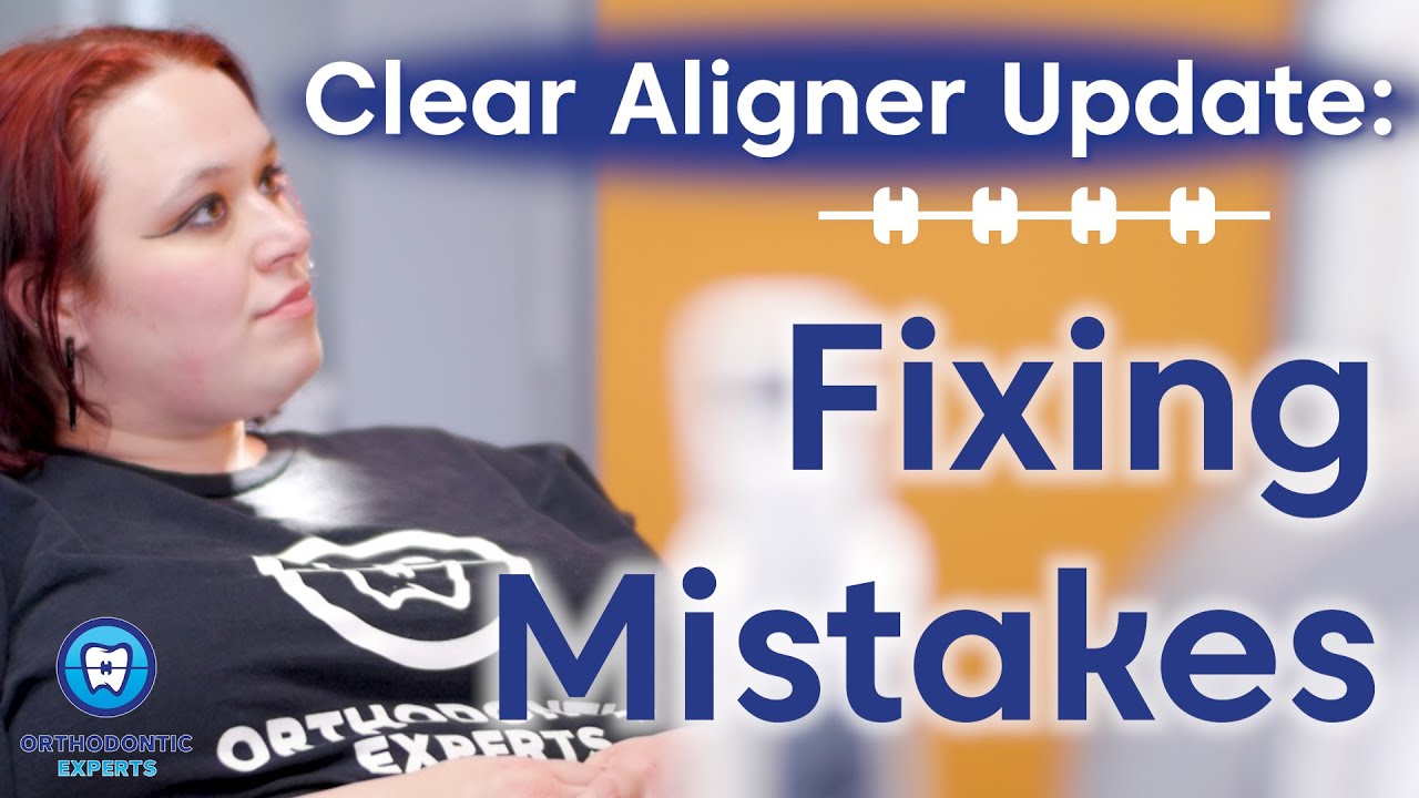 The Aligner Journey | Discover Why Follow-Ups Are Essential!