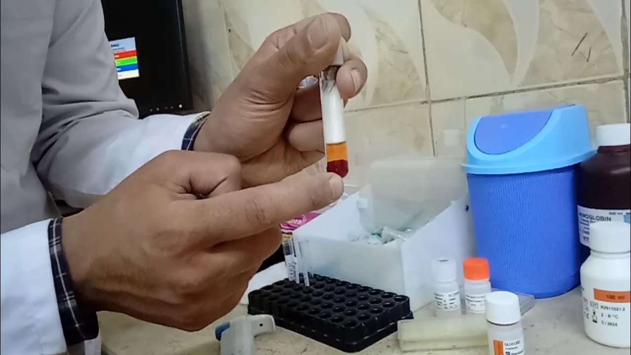 تحليل السكر(glucose) عملي خطوة بخطوة