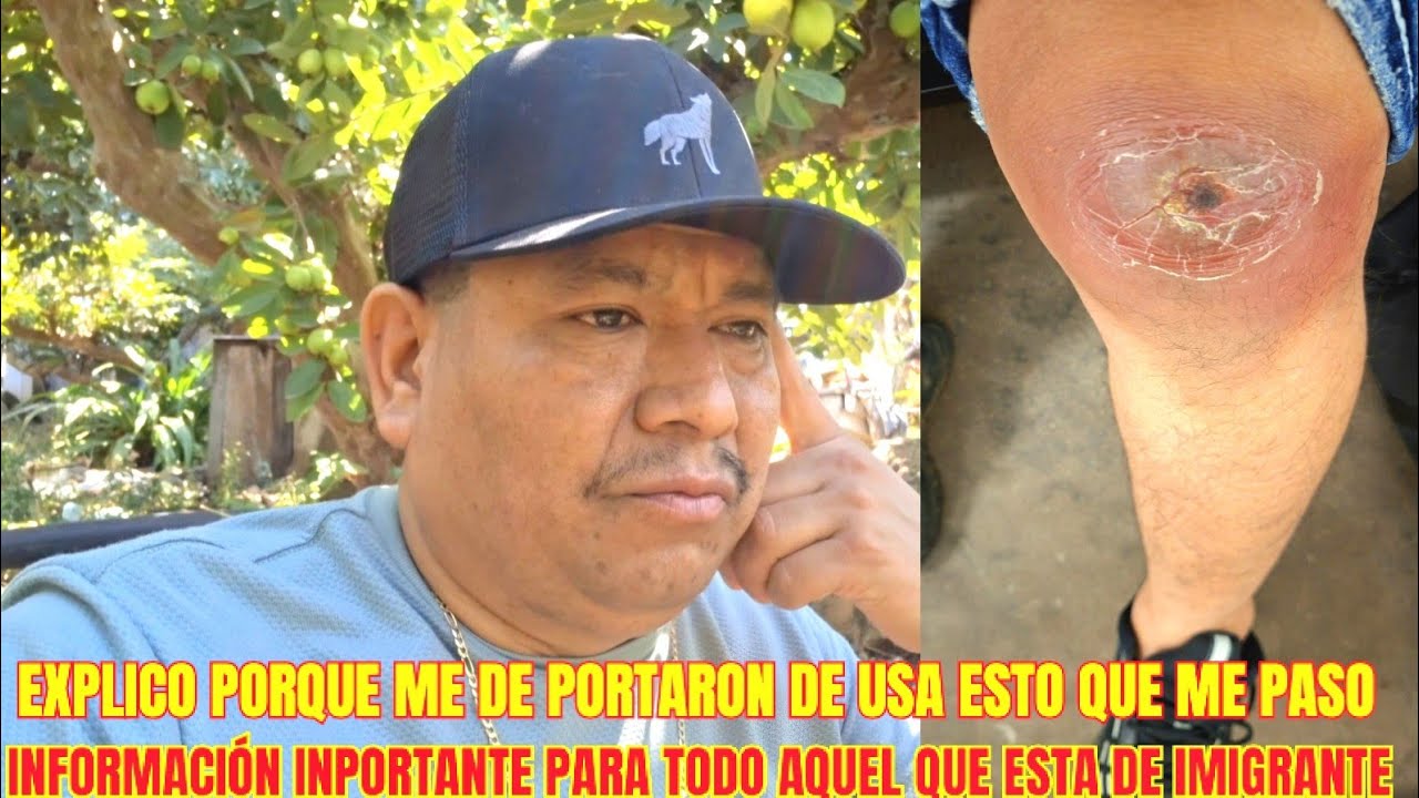 ESTO ME PASO AL SER DE PORTADO DE USA NOS TRATAN SIN CONSIDERACIÓN CUÍDATE AMIGO