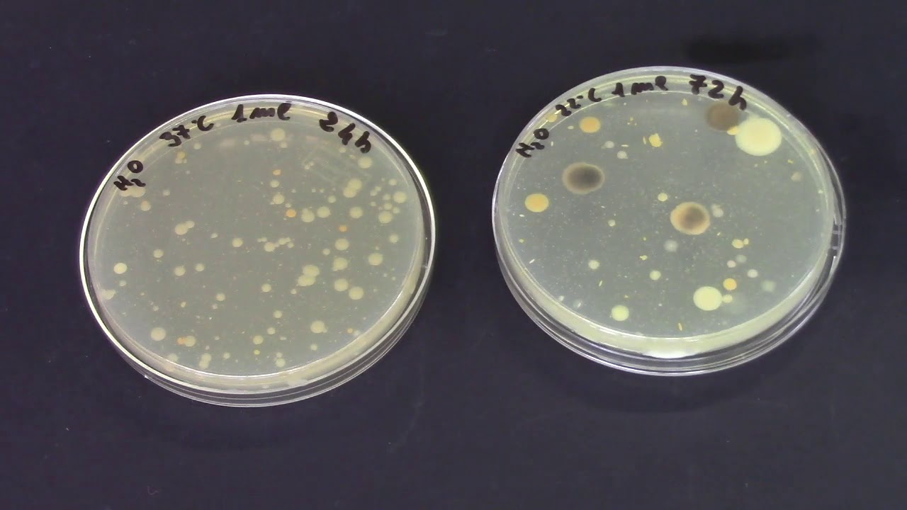 Inquinamento microbiologico dell'acqua