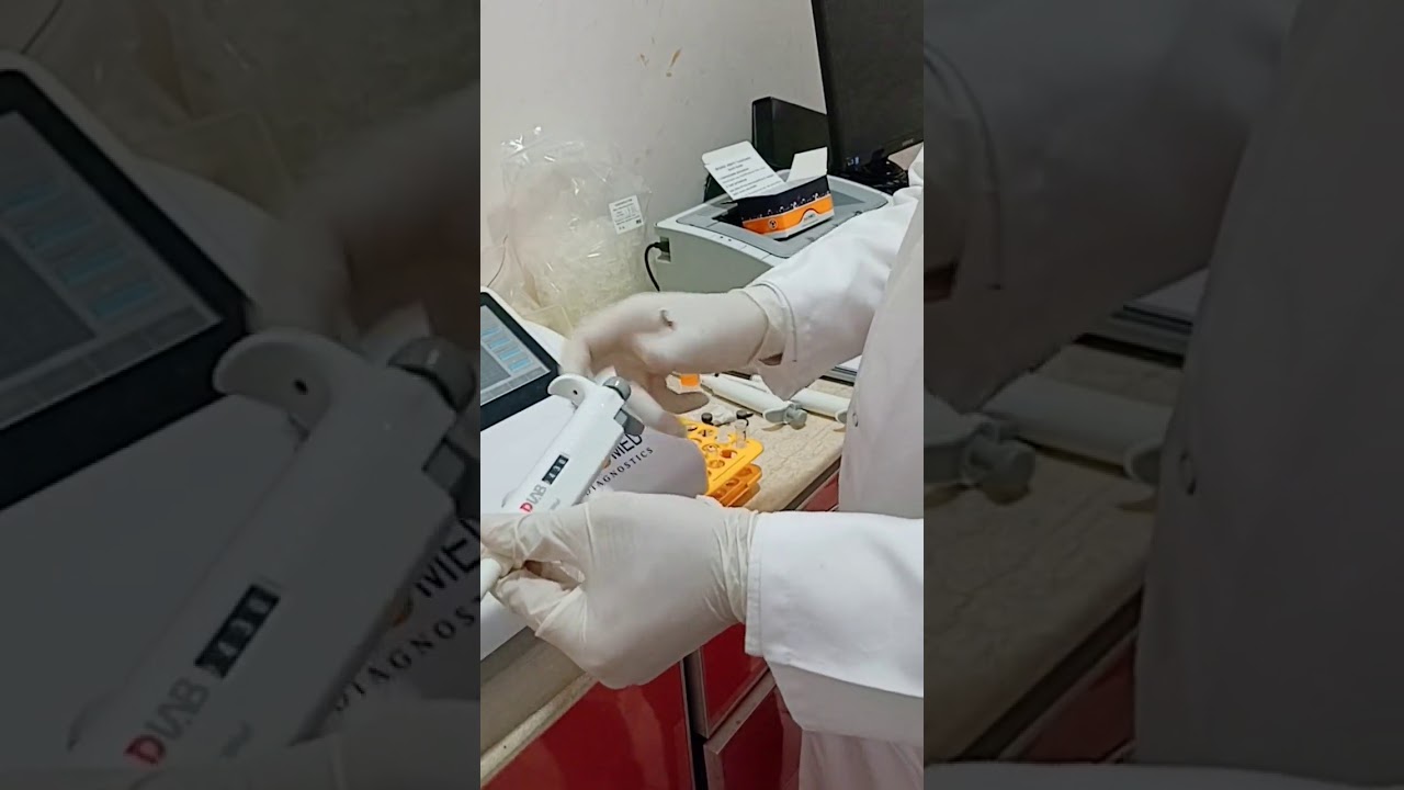 HBA1C BIOMED TURBI(عملي الكيرف)