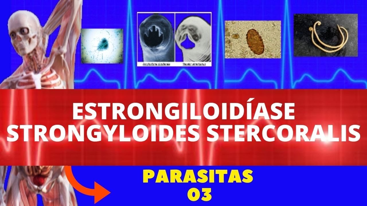 ESTRONGILOIDÍASE - STRONGYLOIDES STERCORALIS (VERMINOSE) - PARASITOLOGIA | INFECTOLOGIA