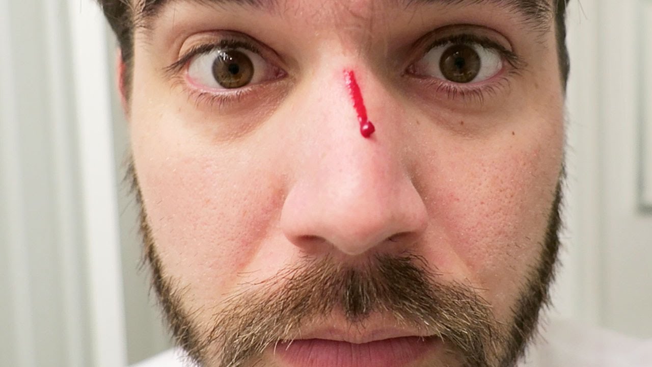 LOST THE FIGHT! (11.10.15 - Day 2386)