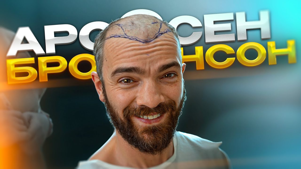 ПЕРЕСАДКА ВОЛОС БОКСЕРУ / АРСЕН БРОНСОН