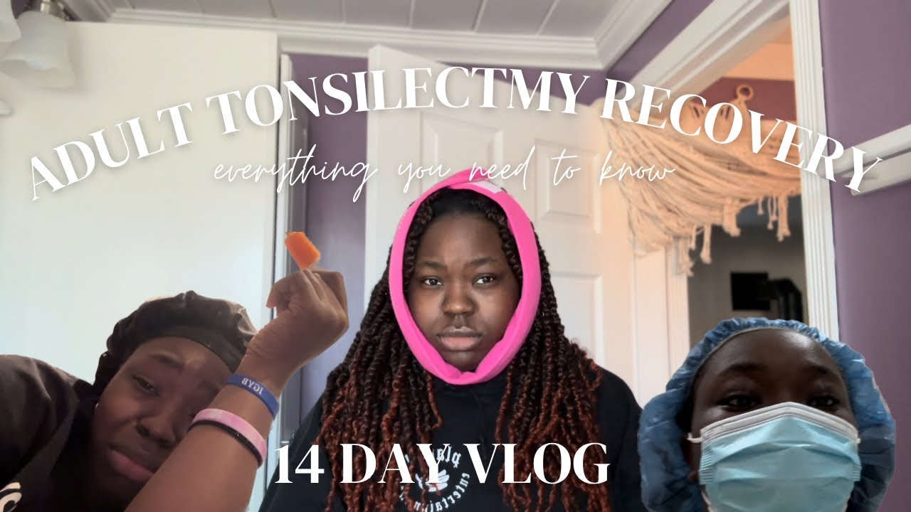 my adult tonsillectomy recovery | everything you need to know | life with karin