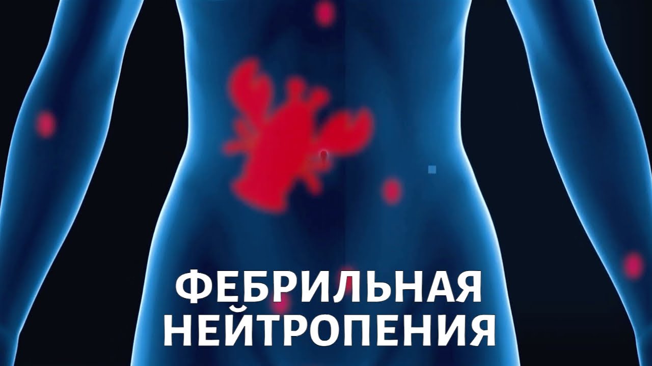 Осложнения во время химиотерапии. Почему возникает фебрильная нейтропения?