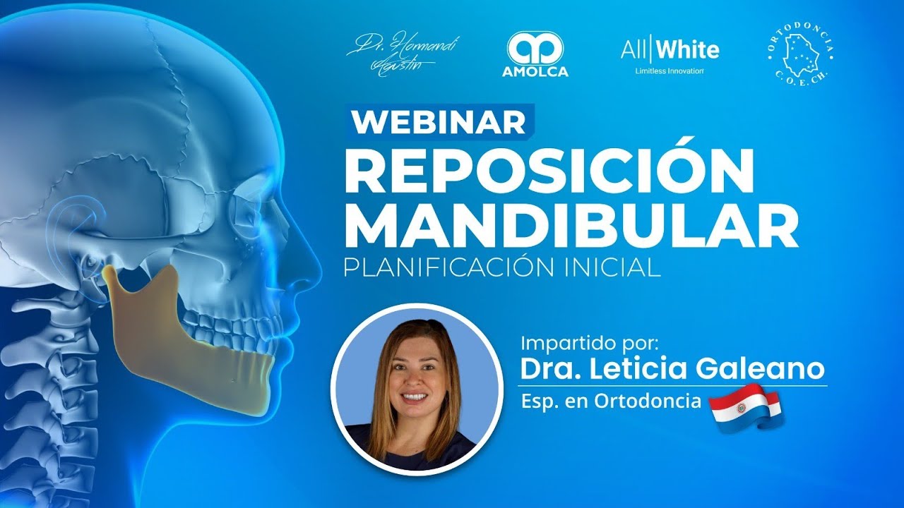 REPOSICIÓN MANDIBULAR | PLANIFICACIÓN INICIAL