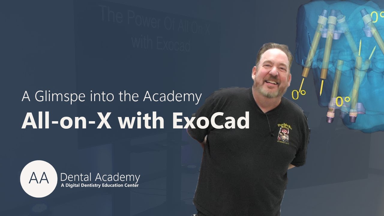 The Power of All-on-X with Exocad | AA Dental Academy