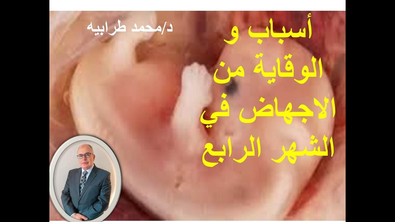 أسباب و الوقاية من الإجهاض في الشهر الرابع .#دكتور_محمد_طرابيه