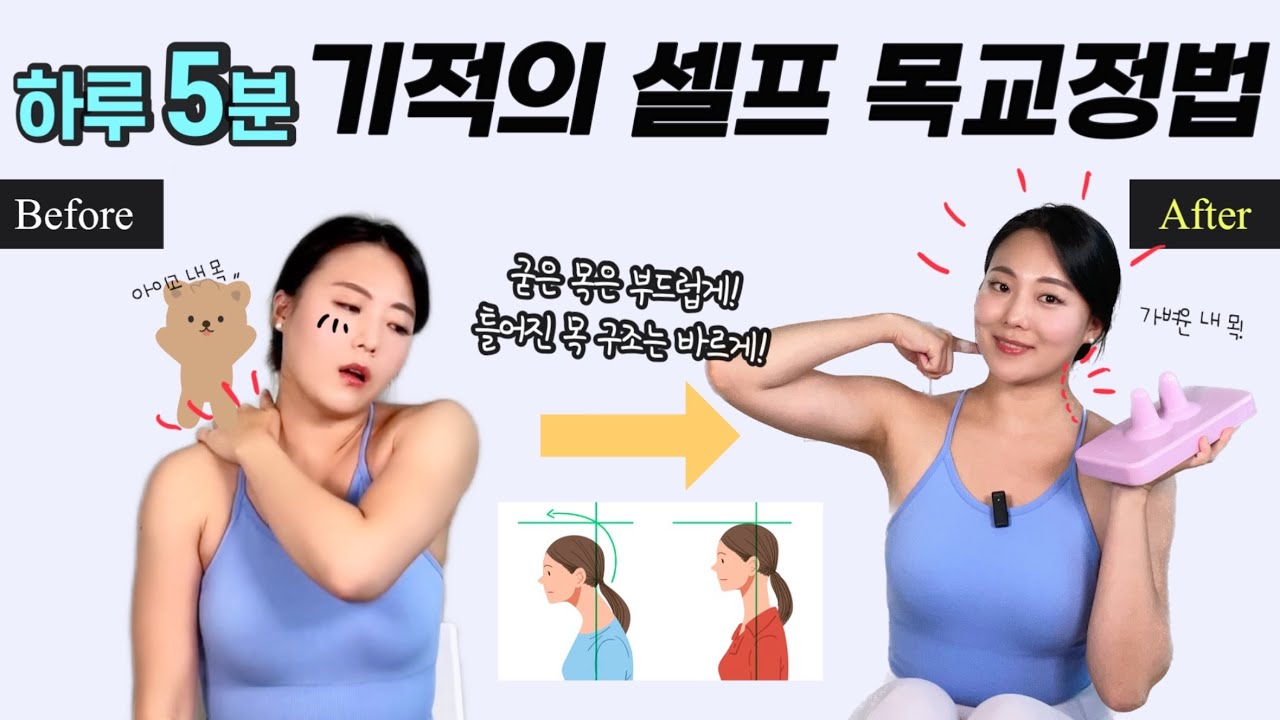 거북목, 일자목, 갸우뚱 비뚤어진 고개! 셀프로 목 교정해주는 방법! 다나손 목 구조 회복 운동 *이제 도수치료,마사지 안받아도됨