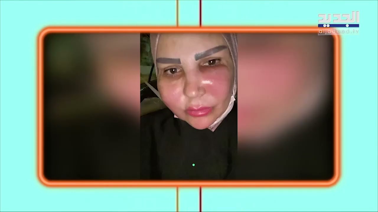 سيدة تعرضت لوعكة صحية بسبب 