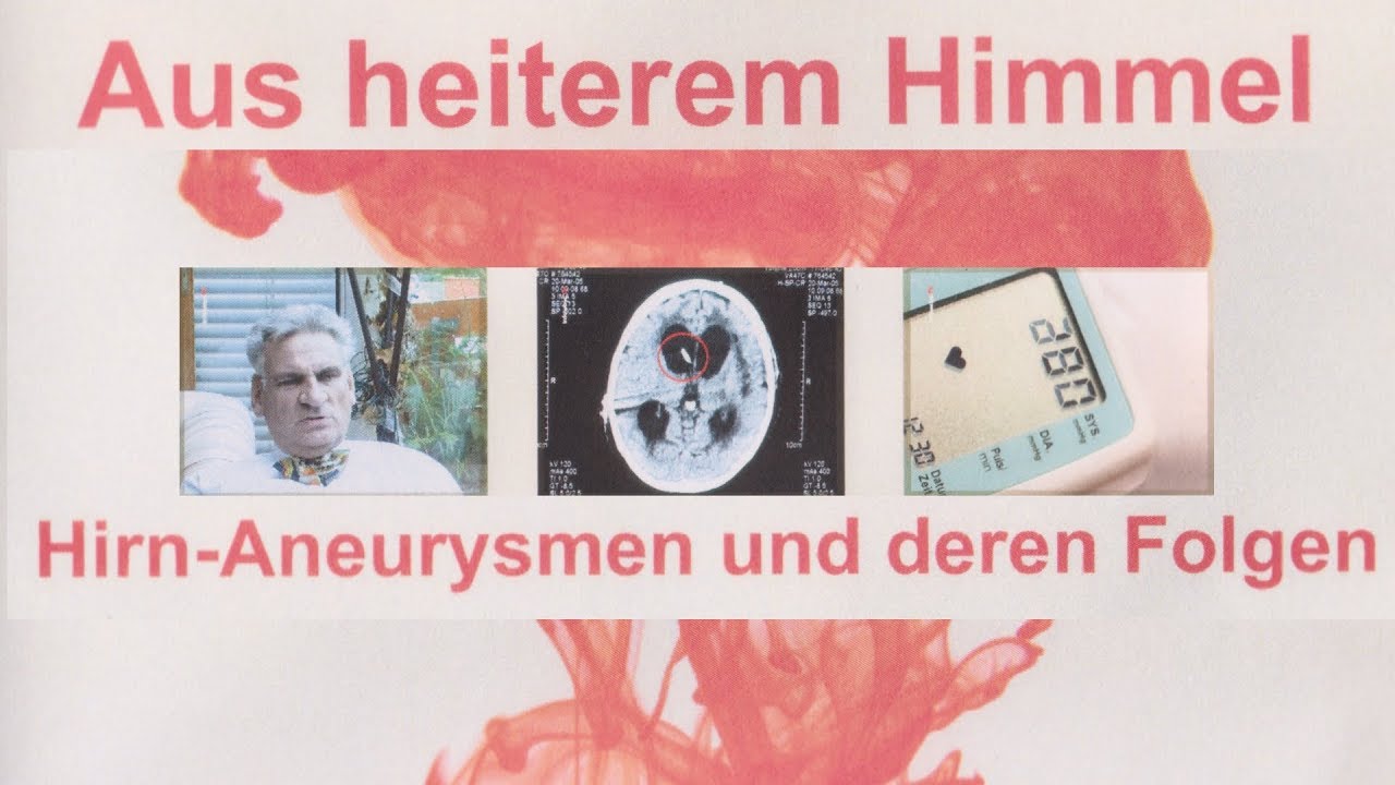Aus heiterem Himmel - Hirn Aneurysmen und deren Folgen