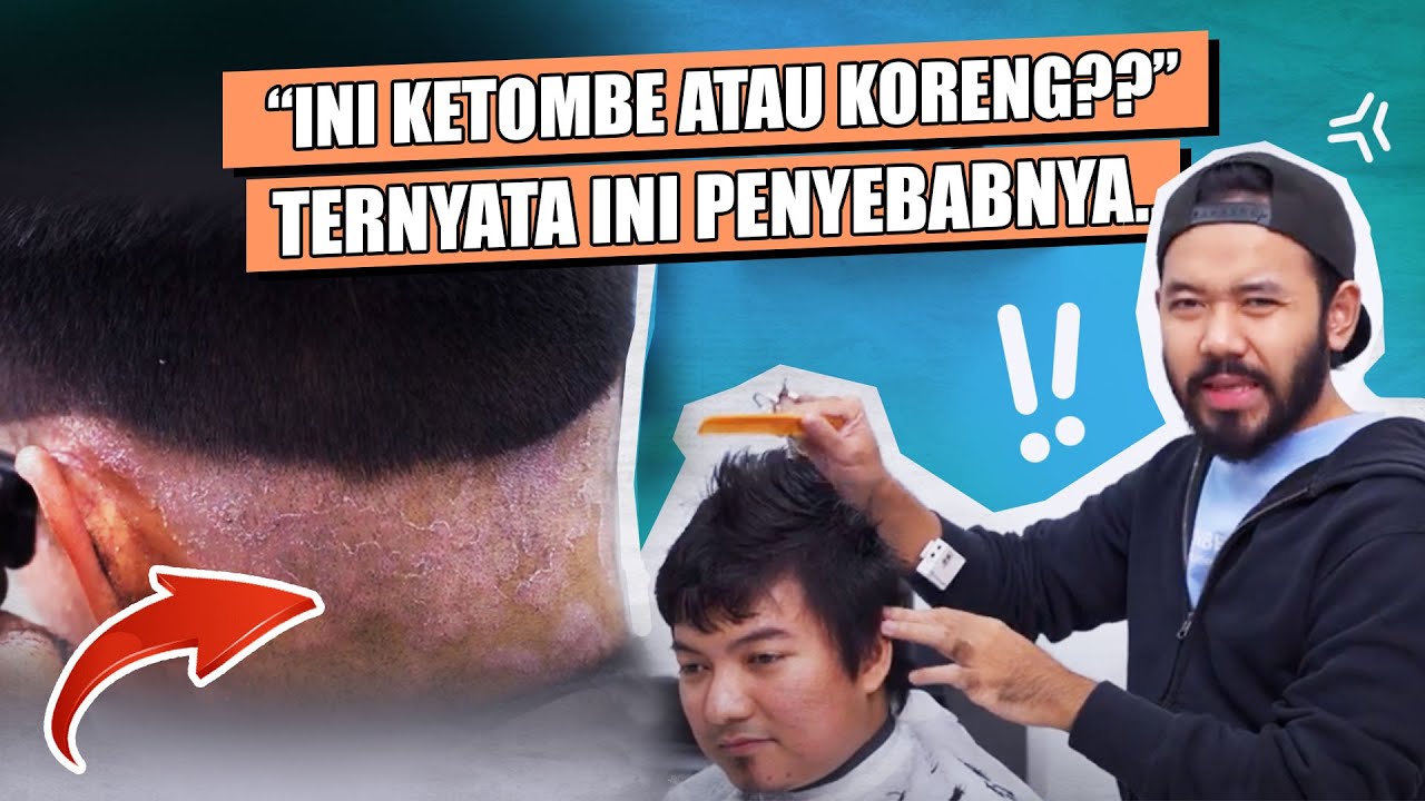 MERINDING!! POTONG RAMBUT KEPALANYA PENUH KETOMBE!! BEGINI SOLUSINYA…