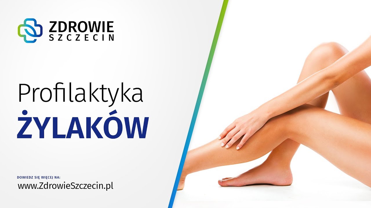 Profilaktyka żylaków - Zdrowie Szczecin
