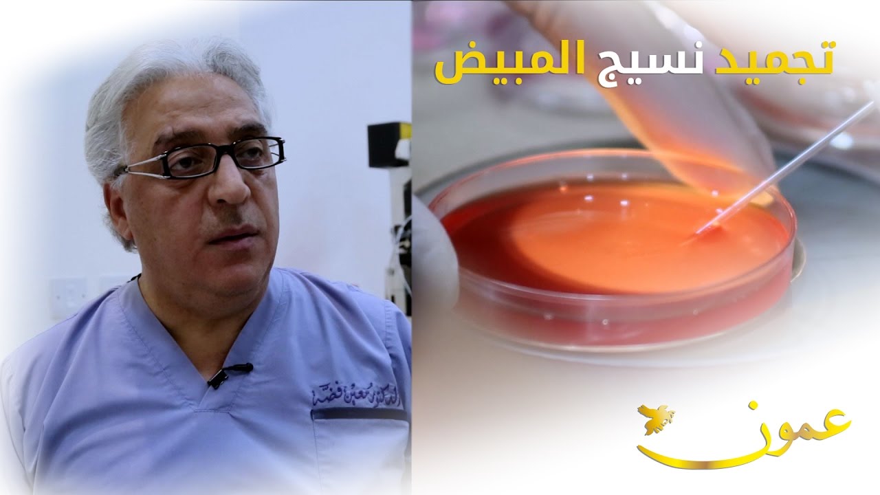 تجميد نسيج المبيض