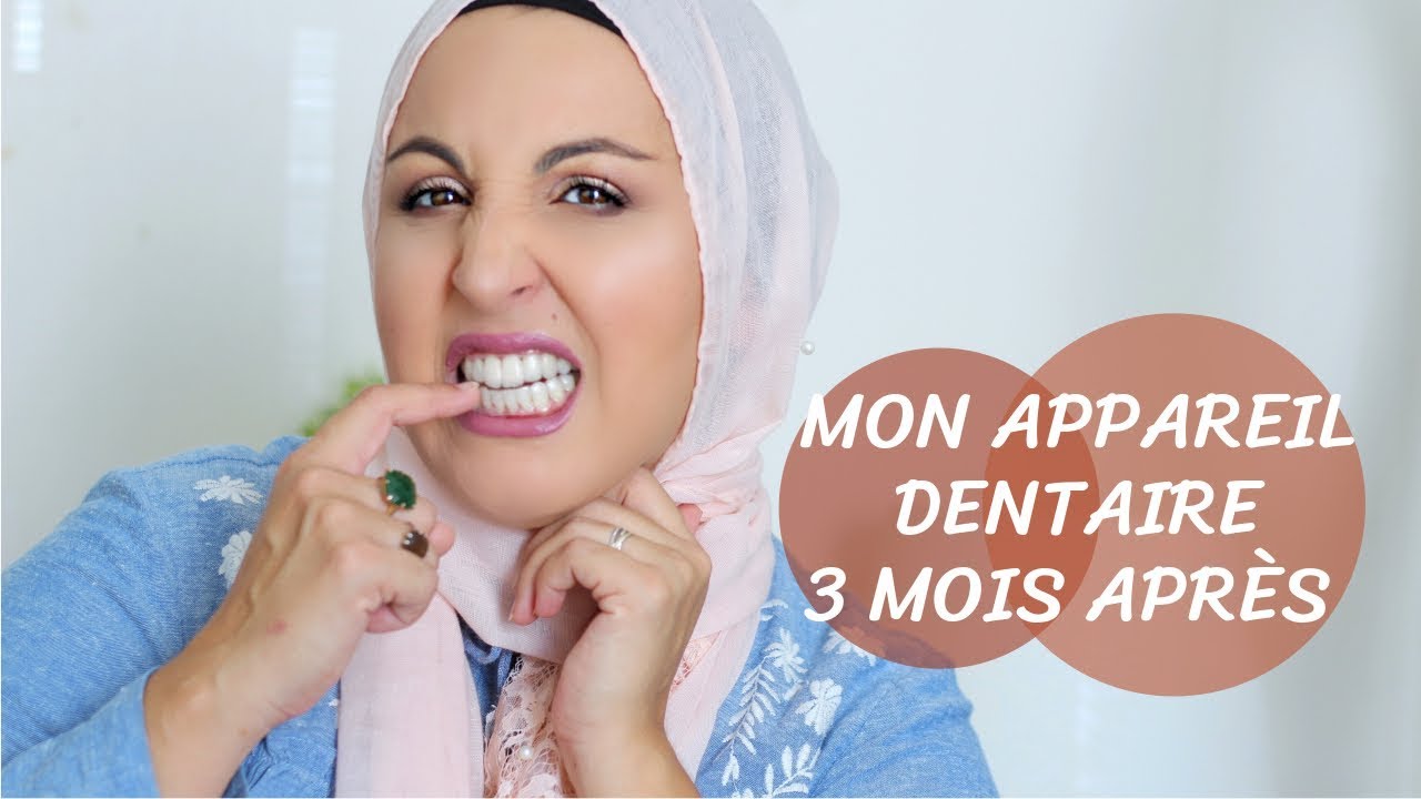 NOUVEAU SOURIRE POUR LA RENTRÉE ! MON APPAREIL DENTAIRE 3 MOIS APRÉS
