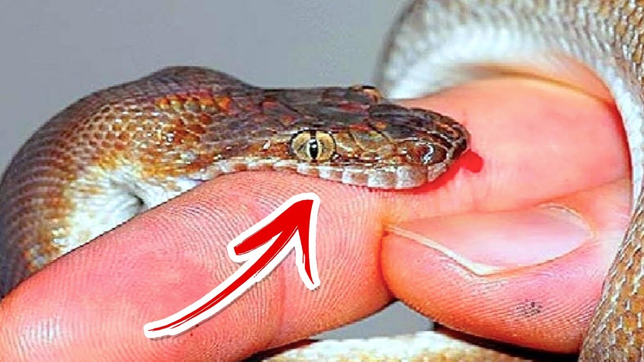 هذا الفيديو يمكن أن ينقذ حياتك.. كيف تنجو من لدغة الثعبان ؟!