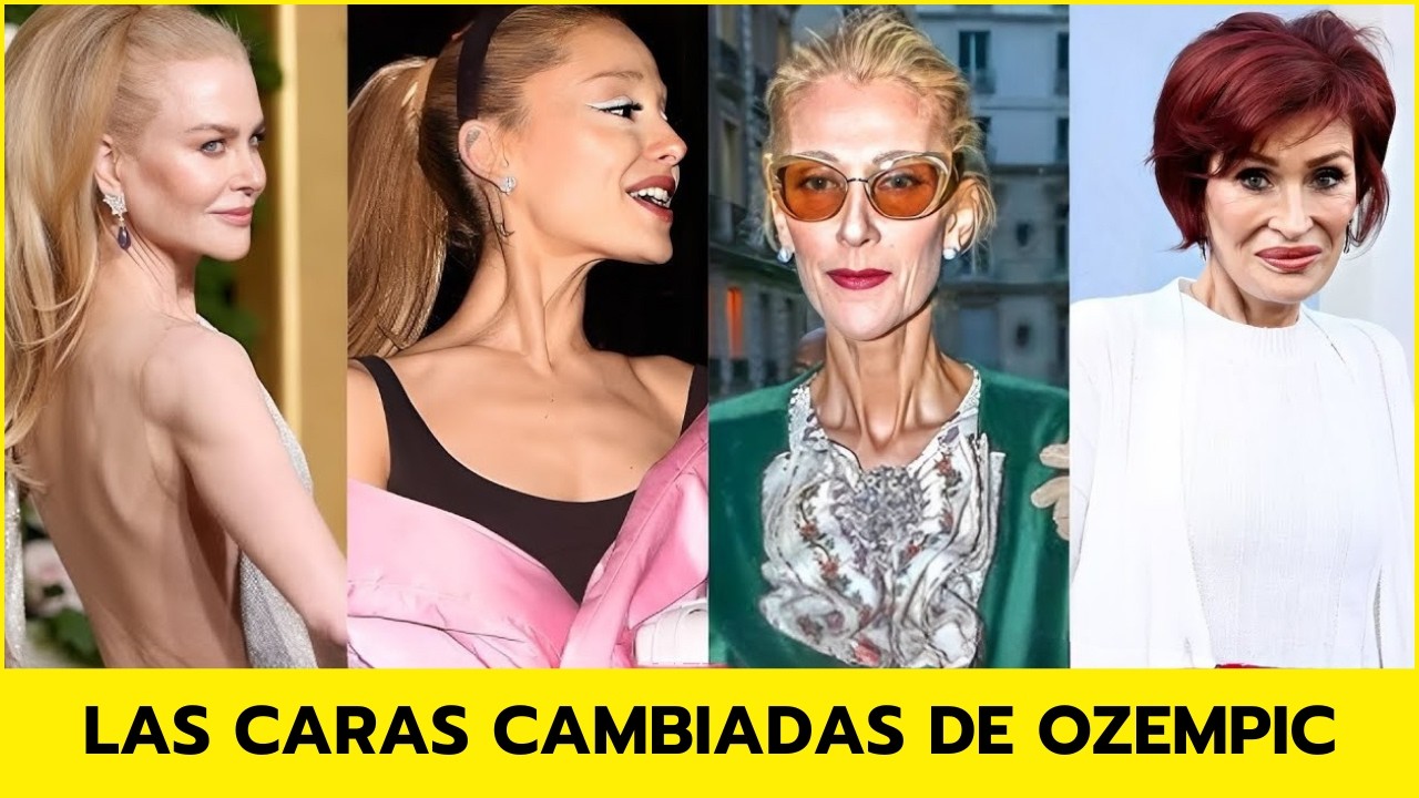 35 famosos con el rostro de Ozempic | Antes y Ahora 2026