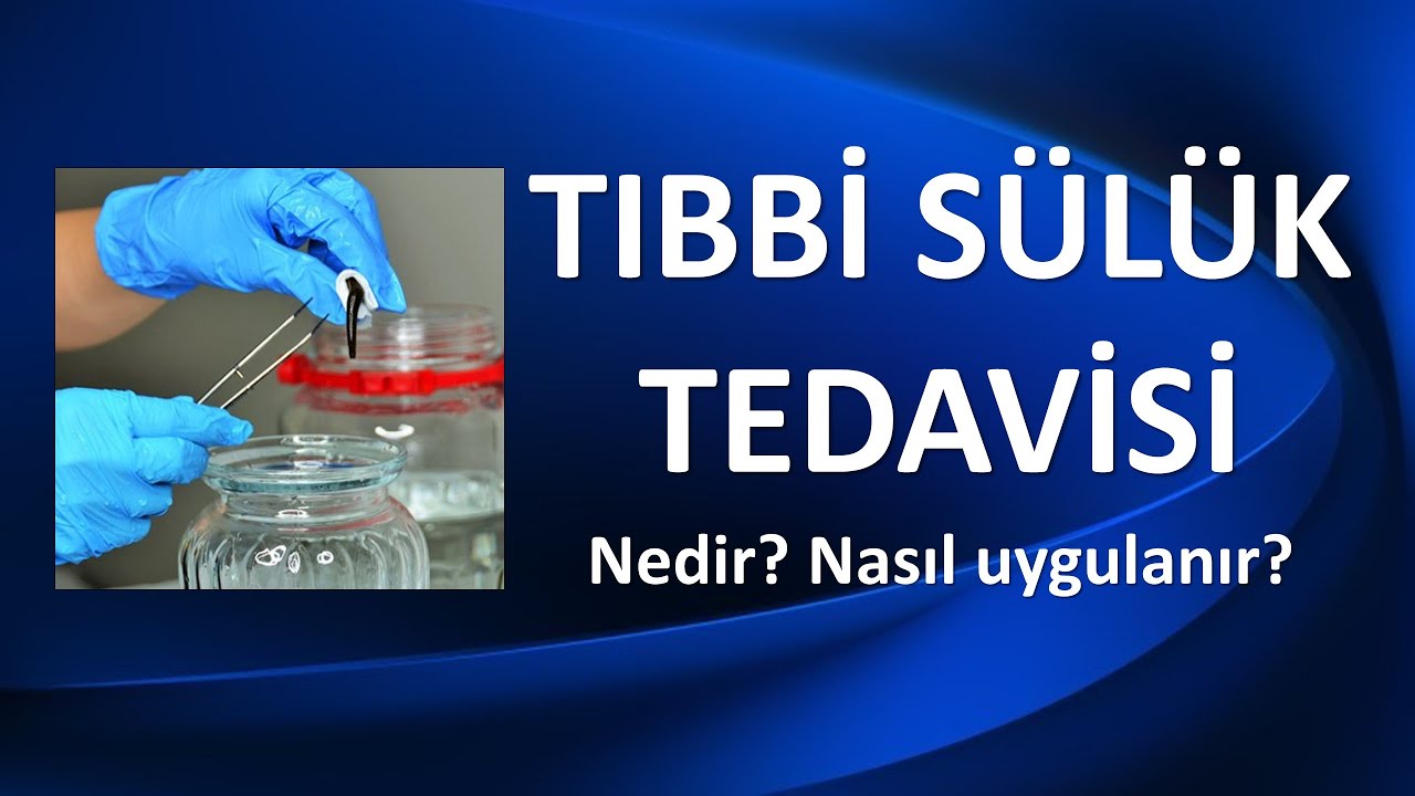 TIBBİ SÜLÜK TEDAVİSİ