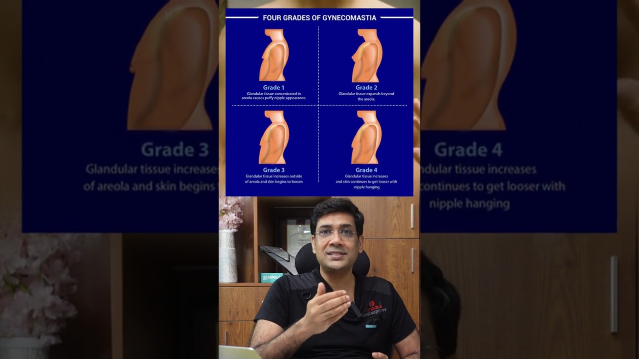 Gynecomastia இருப்பதை கண்டுபிடிப்பது எப்படி ?#malechest  #gynecomastiacbe