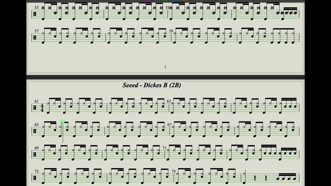 Seeed - Dickes B (2B)