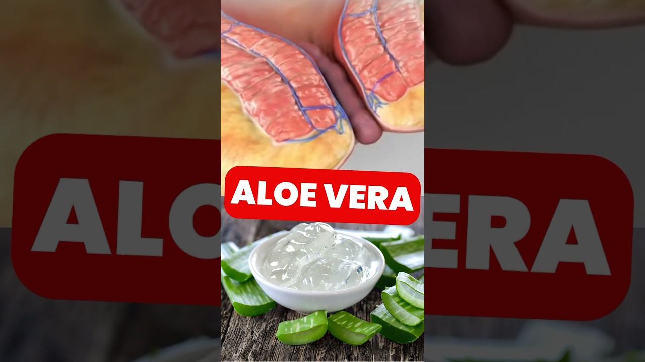 C&oacute;mo Aplicar la SABILA para ALIVIAR tus HEMORROIDES
