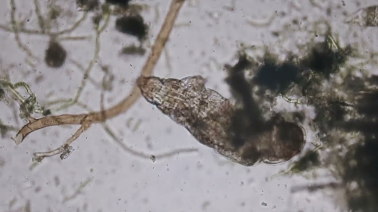 Microbes on My Porch