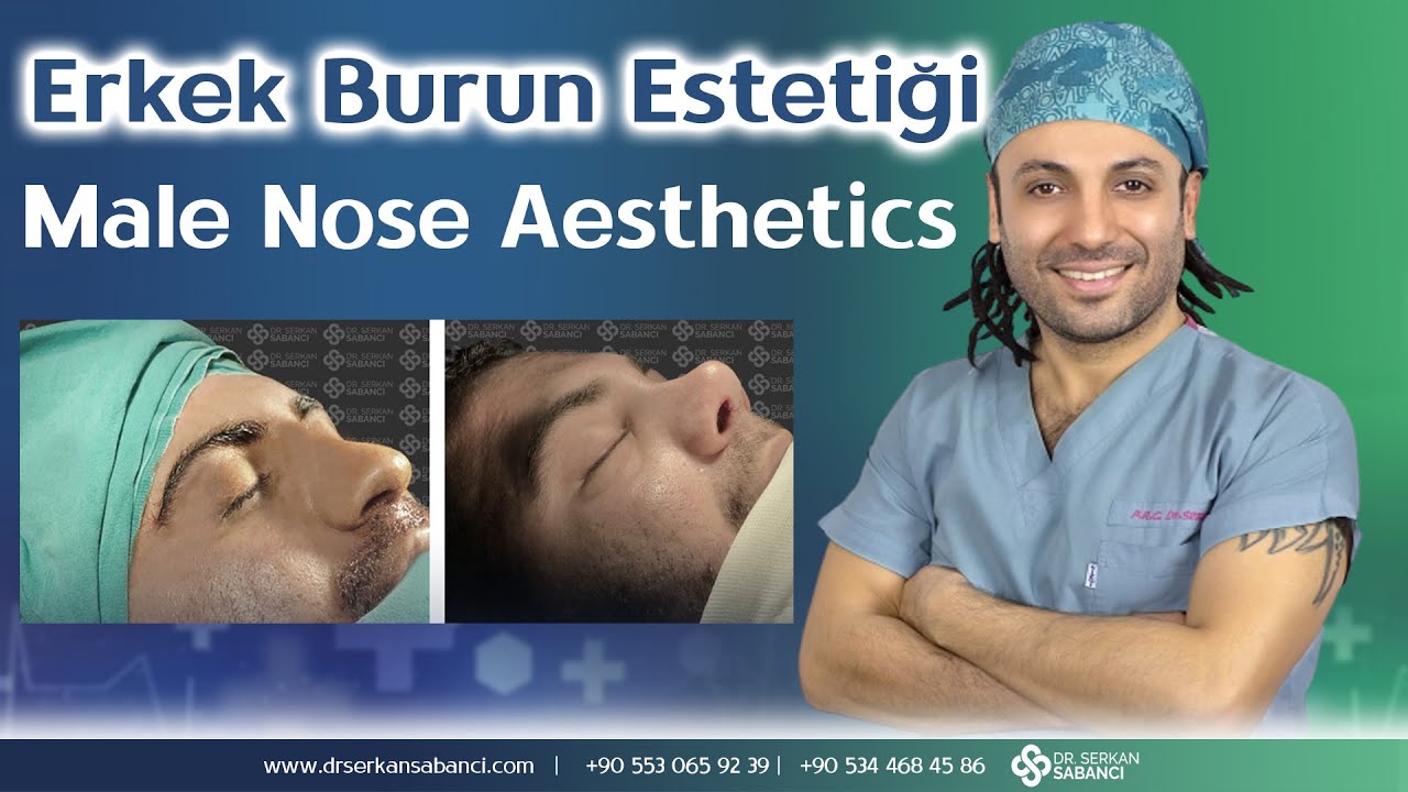 Erkek Burun Estetiği | Male Nose Aesthetics | Op. Dr. Serkan Sabancı