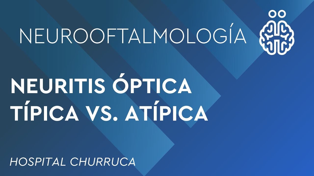 NEURITIS ÓPTICA TÍPICA VS. ATÍPICA