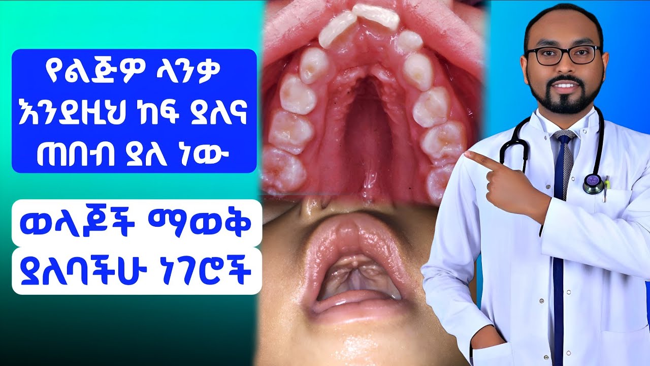 የልጅዎ ላንቃ እንደዚህ ከፍ ያለና ጠበብ ያለ ነው | ማወቅ ያለባችሁ ነገሮች  | Your baby's palate is this high and narrow