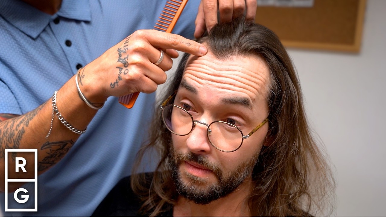 He Wanted to Look 21 AGAIN... 25 YEARS Later with a Receding Hairline