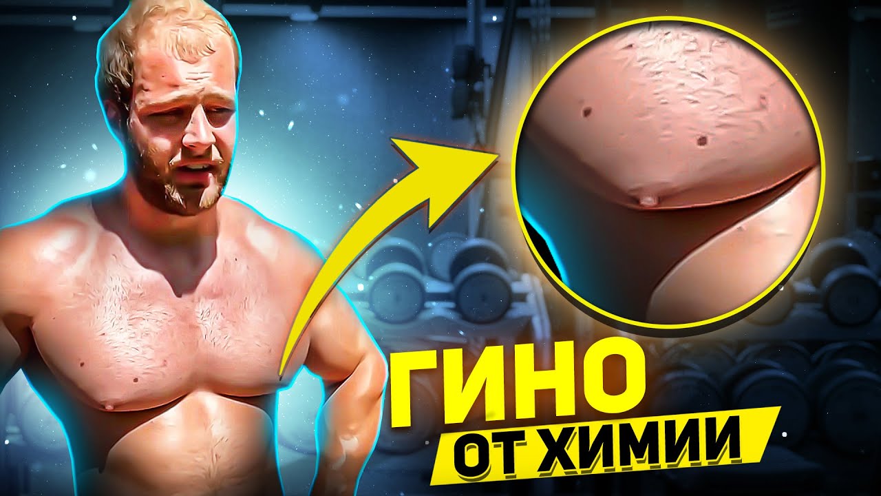 ПОЙМАНЫ НА ЛЖИ / ГИНО И ПРЫЩИ ОТ ХИМИИ