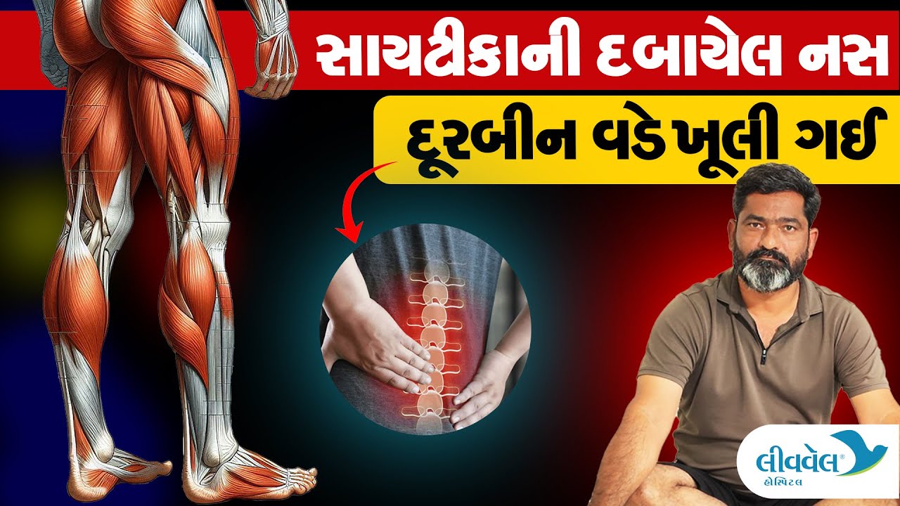 Sciatica Treatment with Spine Endoscopy - Minimal Procedure | Livewell Hospital Ahmedabad