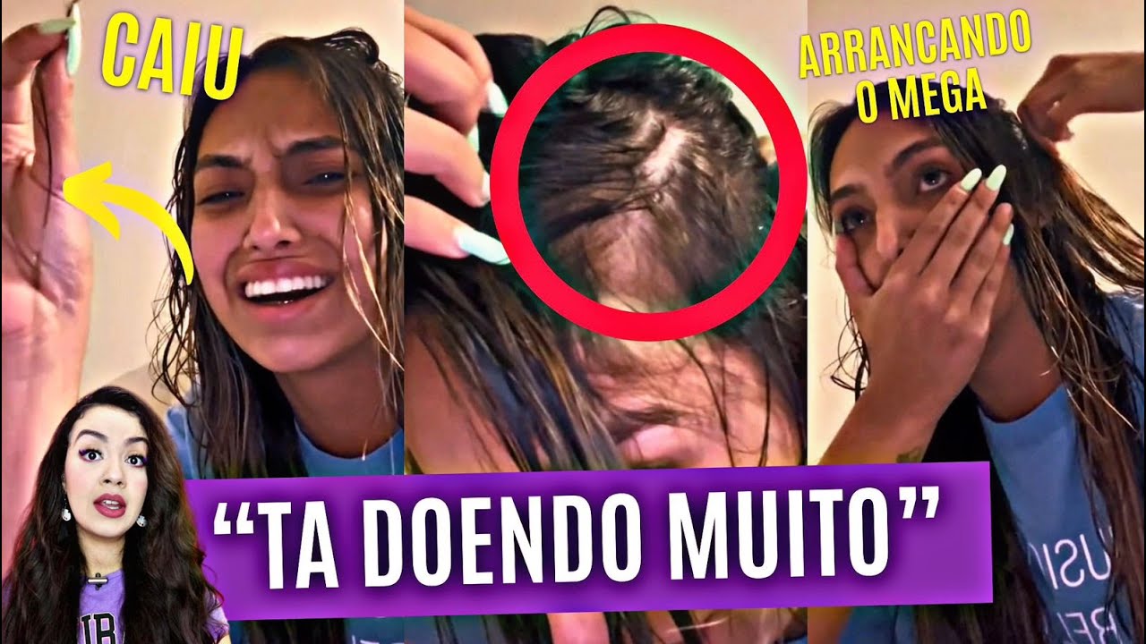 TA FICANDO CARECA! VANESSA LOPES REVELA QUEDA CAPILAR POR USO DE MEGAHAIR 😨