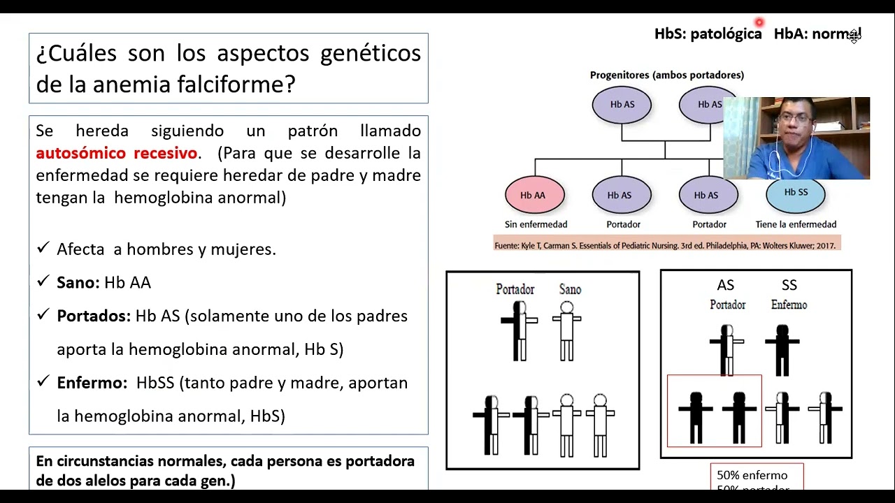Herencia de la Anemia de Células Falciforme