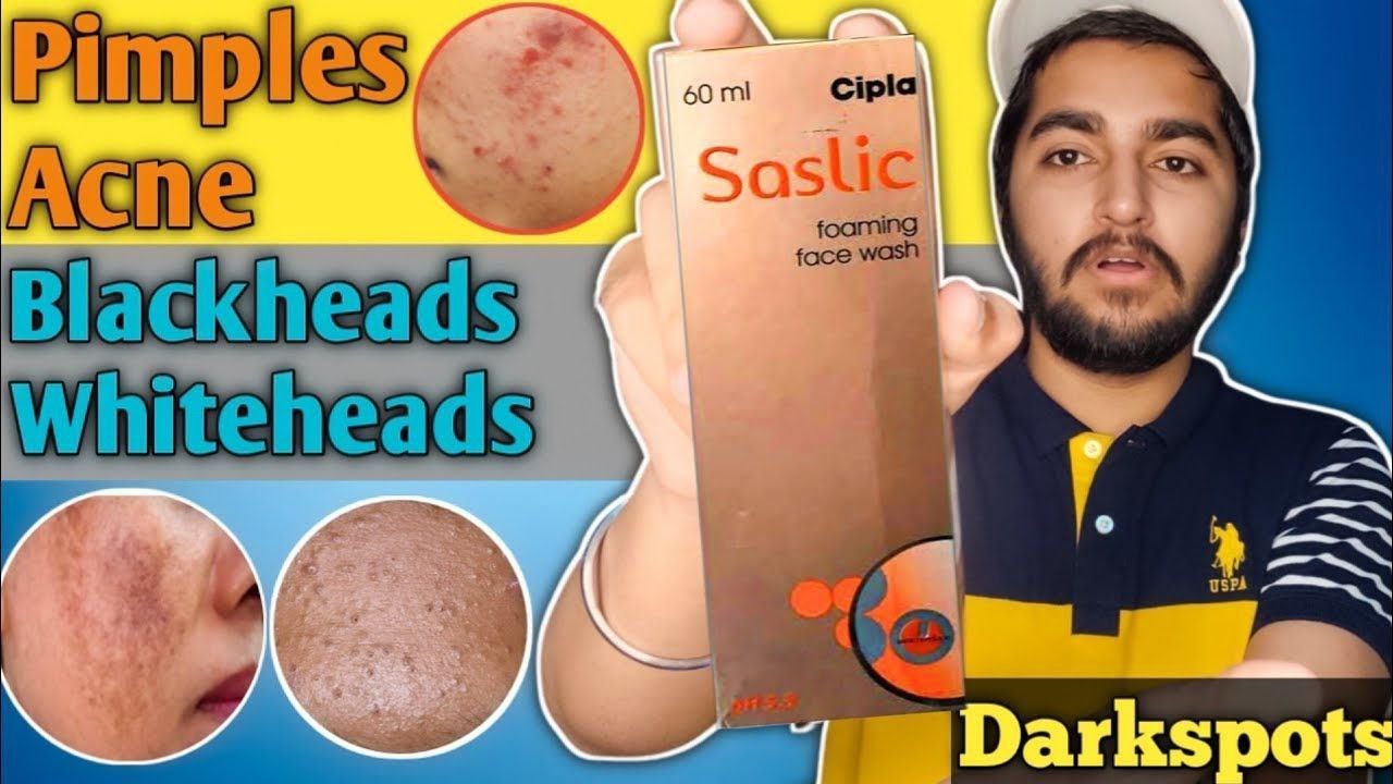 Saslic Foaming Face Wash Review | How To Use Saslic Foaming Face Wash | Saslic ds Face Wash