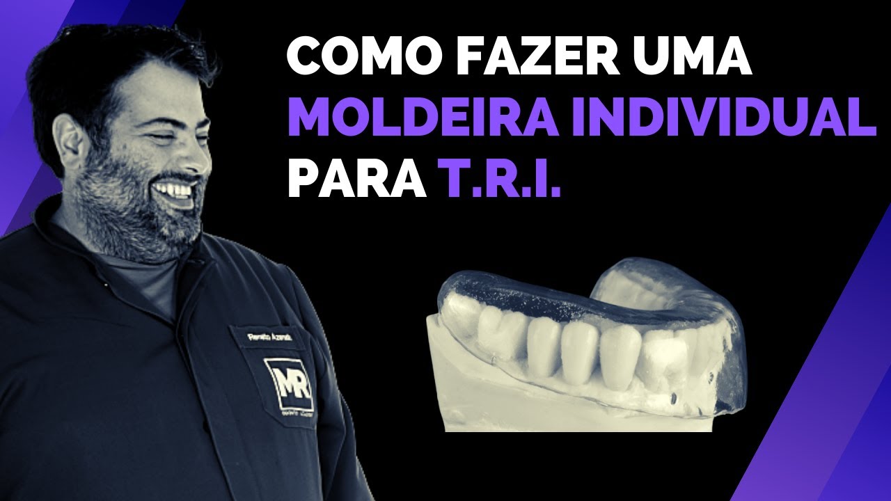 COMO FAZER UMA MOLDEIRA INDIVIDUAL PARA A - T.R.I - Técnica da Resina Inabalável.