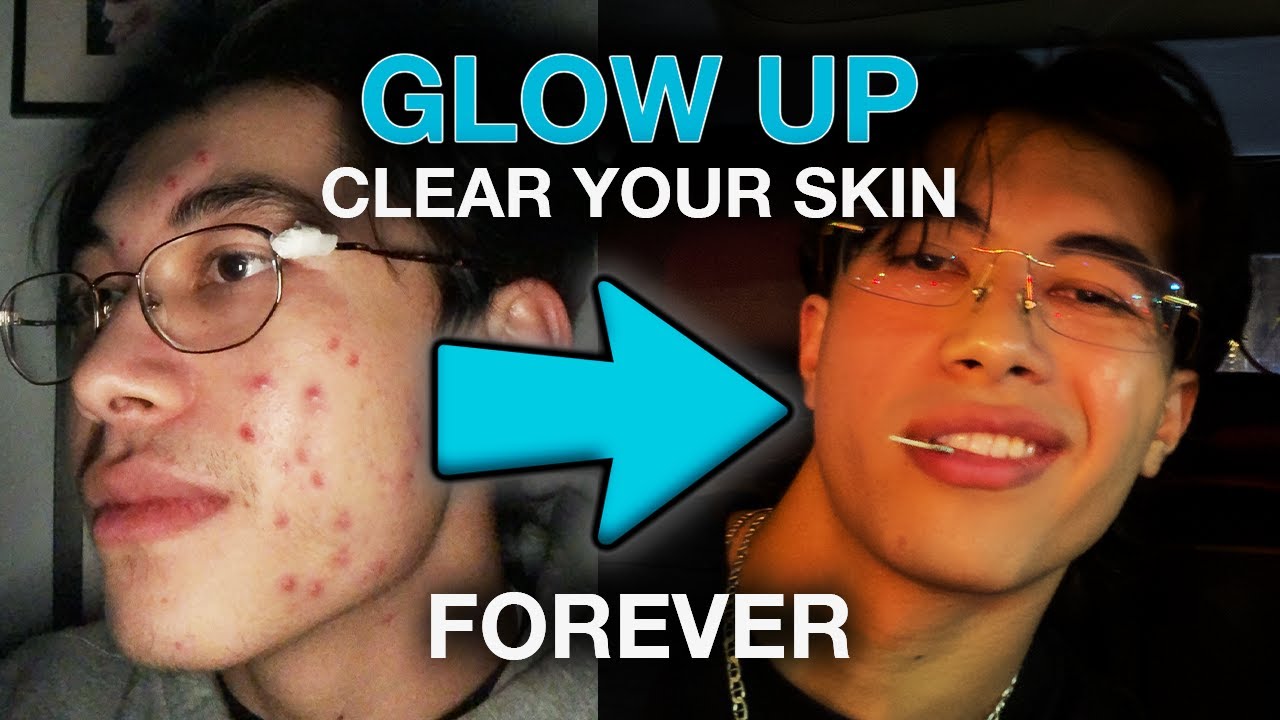 how to clear your skin & glow up forever (+ skincare routine)